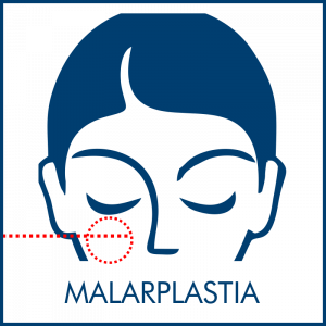 RINOFAST - MALARPLASTIA