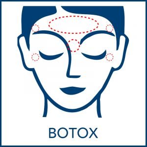 donde-se-aplica-el-botox